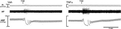 Hypersensitivity of Vagal Pulmonary Afferents Induced by Tumor Necrosis Factor Alpha in Mice